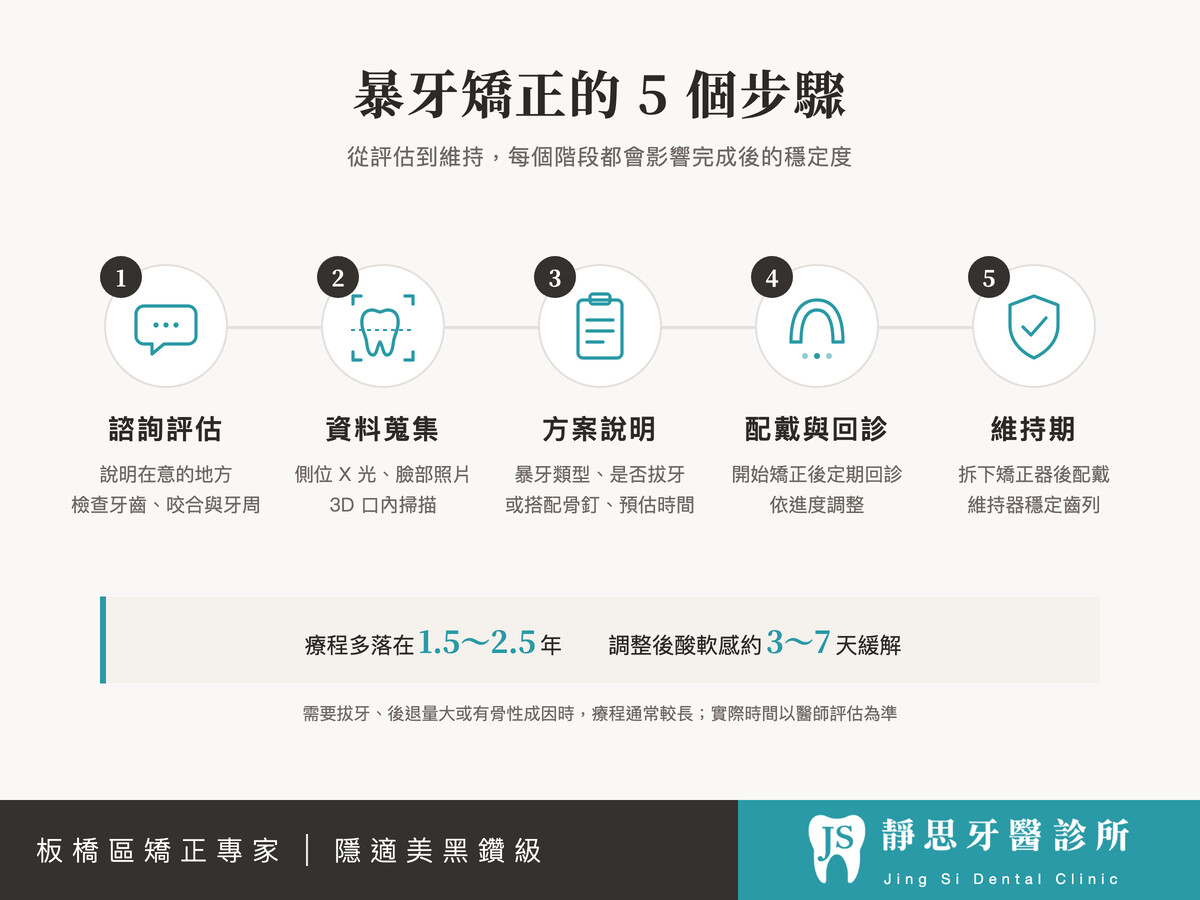 暴牙矯正的5個步驟:諮詢評估、資料蒐集、方案說明、配戴與回診、維持期